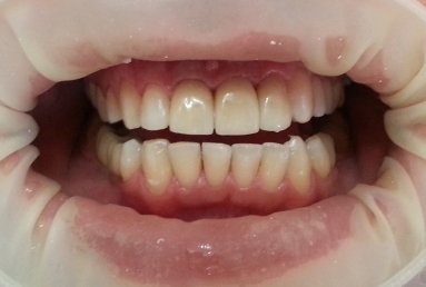 tratament ortodontic