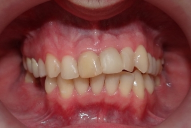 tratament ortodontic