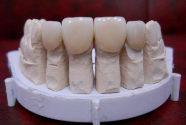 fatete ceramice